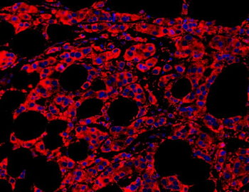 MyD88 Antibody