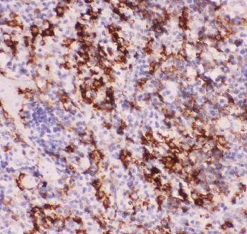 MyD88 Antibody
