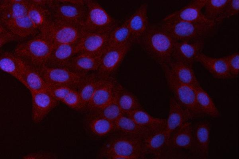 NFkB/NFKB1 p105/p50 Rabbit Polyclonal Antibody