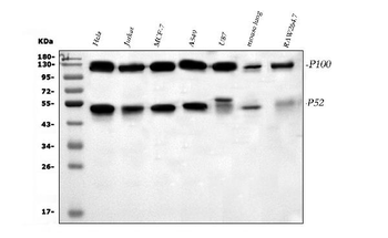 NFkB/NFKB2 p100/p52 Rabbit Polyclonal Antibody