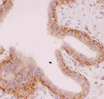 Sodium/Hydrogen Exchanger 1/SLC9A1 Rabbit Polyclonal Antibody