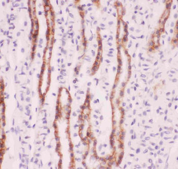 Sodium/Hydrogen Exchanger 1/SLC9A1 Rabbit Polyclonal Antibody
