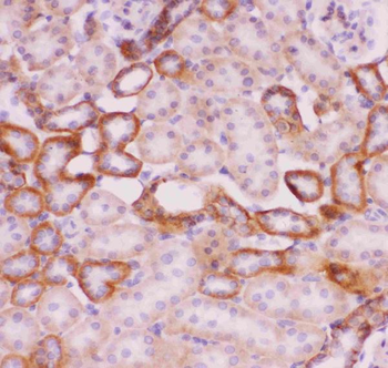 Sodium/Hydrogen Exchanger 1/SLC9A1 Rabbit Polyclonal Antibody