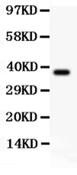 Sodium/Hydrogen Exchanger 1/SLC9A1 Rabbit Polyclonal Antibody