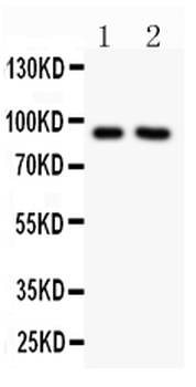 Sodium/Hydrogen Exchanger 1/SLC9A1 Rabbit Polyclonal Antibody