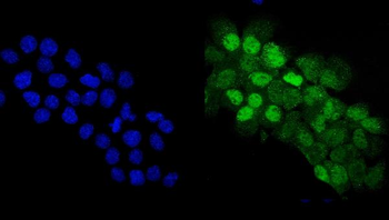 p63/TP63 Rabbit Polyclonal Antibody