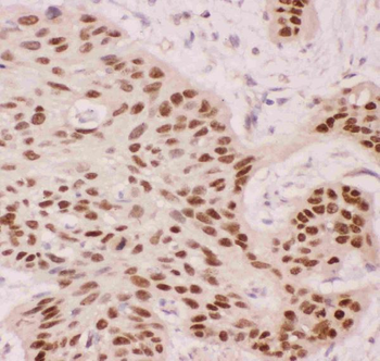p63/TP63 Rabbit Polyclonal Antibody