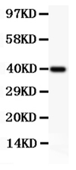 Perforin/PRF1 Rabbit Polyclonal Antibody