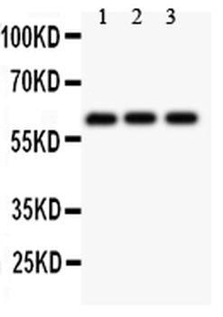 Perforin/PRF1 Rabbit Polyclonal Antibody