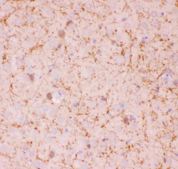 SIRT2 Rabbit Polyclonal Antibody