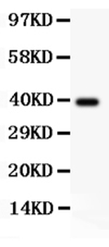 TdT/DNTT Rabbit Polyclonal Antibody