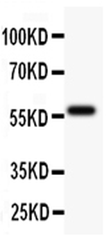 TdT/DNTT Rabbit Polyclonal Antibody