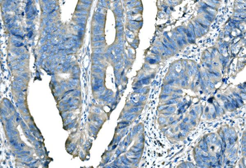 B Raf/BRAF Antibody