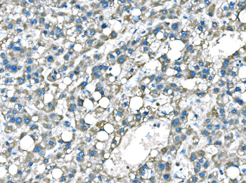 B Raf/BRAF Antibody