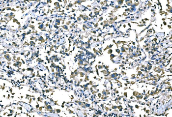 B Raf/BRAF Antibody