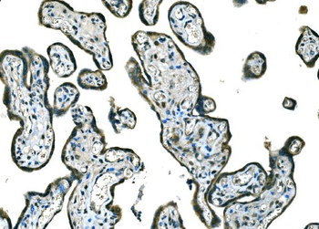 B Raf/BRAF Antibody