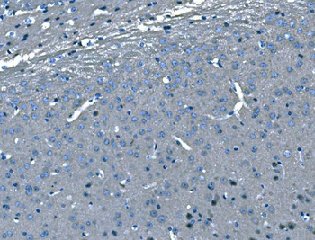 B Raf/BRAF Antibody