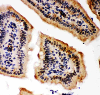 KAT3B/p300/EP300 Antibody