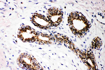 FHIT Rabbit Polyclonal Antibody