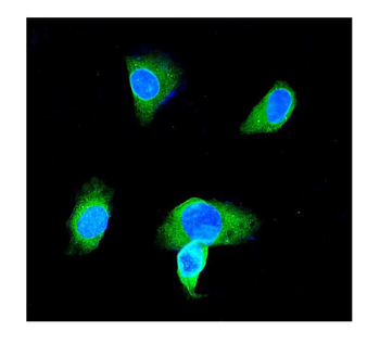 GST3/GST pi/GSTP1 Rabbit Polyclonal Antibody