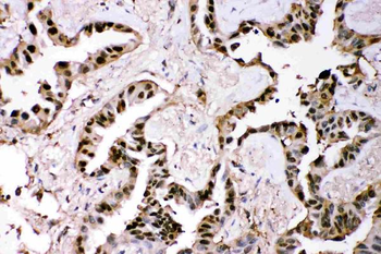 GST3/GST pi/GSTP1 Rabbit Polyclonal Antibody