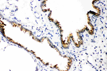 GST3/GST pi/GSTP1 Rabbit Polyclonal Antibody