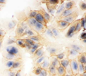 gamma Catenin/JUP Antibody
