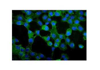 gamma Catenin/JUP Antibody