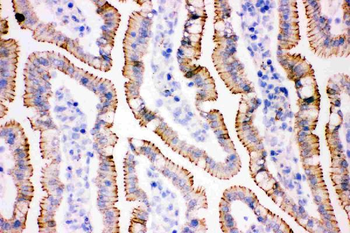 gamma Catenin/JUP Antibody