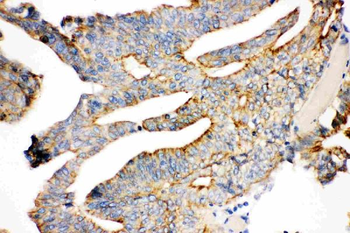 gamma Catenin/JUP Antibody