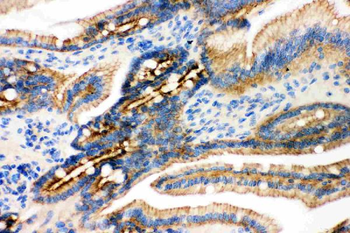 gamma Catenin/JUP Antibody