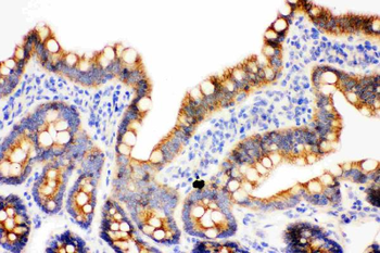 gamma Catenin/JUP Antibody