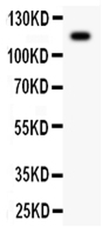 C5/C5a Rabbit Polyclonal Antibody