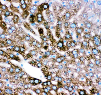 Cytochrome P450 2E1/CYP2E1 Rabbit Polyclonal Antibody