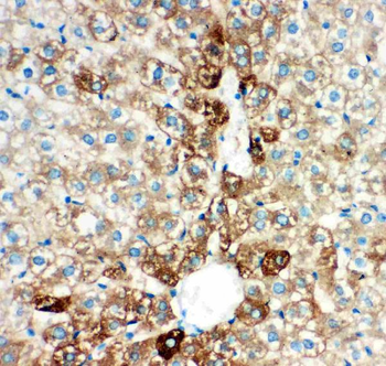 Cytochrome P450 2E1/CYP2E1 Rabbit Polyclonal Antibody