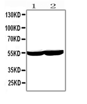 Cytochrome P450 2E1/CYP2E1 Rabbit Polyclonal Antibody