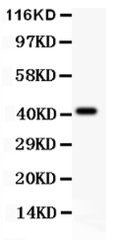 EDA Rabbit Polyclonal Antibody
