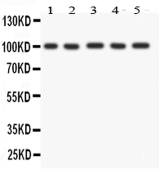 FGFR4 Antibody