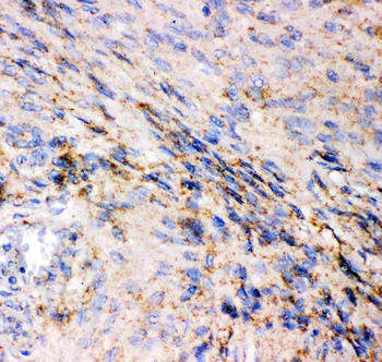 Glutamate Receptor 1/GRIA1 Rabbit Polyclonal Antibody