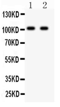 Glutamate receptor 3/GRIA3 Rabbit Polyclonal Antibody