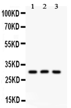 HOXA9 Rabbit Polyclonal Antibody