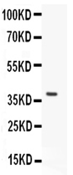 HOXA11 Rabbit Polyclonal Antibody