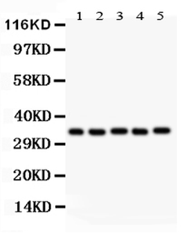 HOXA11 Rabbit Polyclonal Antibody