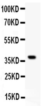 HRG Rabbit Polyclonal Antibody