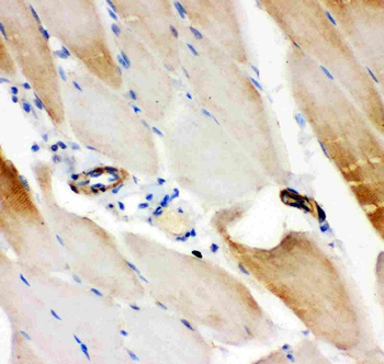 IRS1 Rabbit Polyclonal Antibody