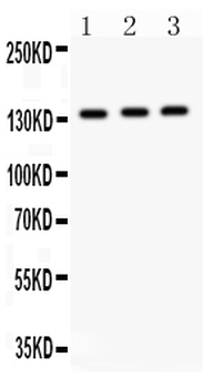 IRS1 Rabbit Polyclonal Antibody