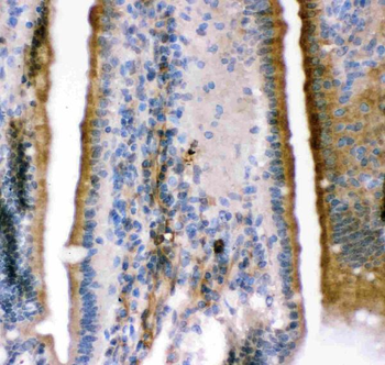 Maxi Potassium channel alpha/KCNMA1 Rabbit Polyclonal Antibody