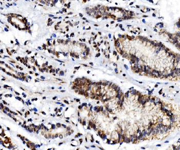 Glucocorticoid Receptor/NR3C1 Rabbit Polyclonal Antibody