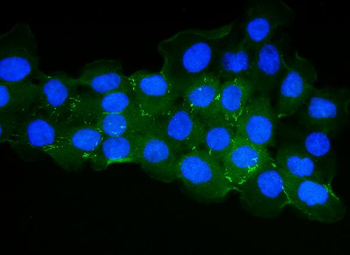 ZO1 tight junction protein/TJP1 Rabbit Polyclonal Antibody