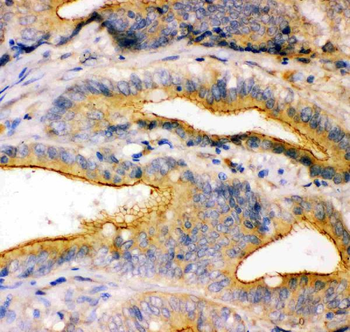 ZO1 tight junction protein/TJP1 Rabbit Polyclonal Antibody